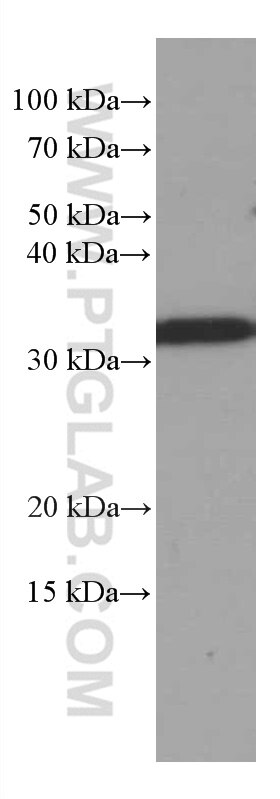 Western Blot (WB) analysis of K-562 cells using MMACHC Monoclonal antibody (66609-1-Ig)