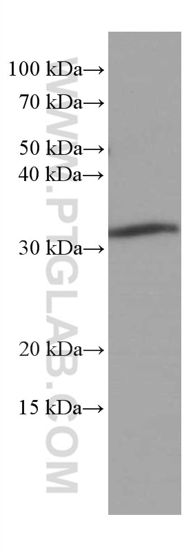 Western Blot (WB) analysis of RAW 264.7 cells using MMACHC Monoclonal antibody (66609-1-Ig)