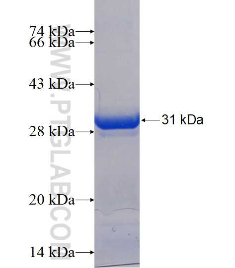 MMACHC fusion protein Ag15001 SDS-PAGE