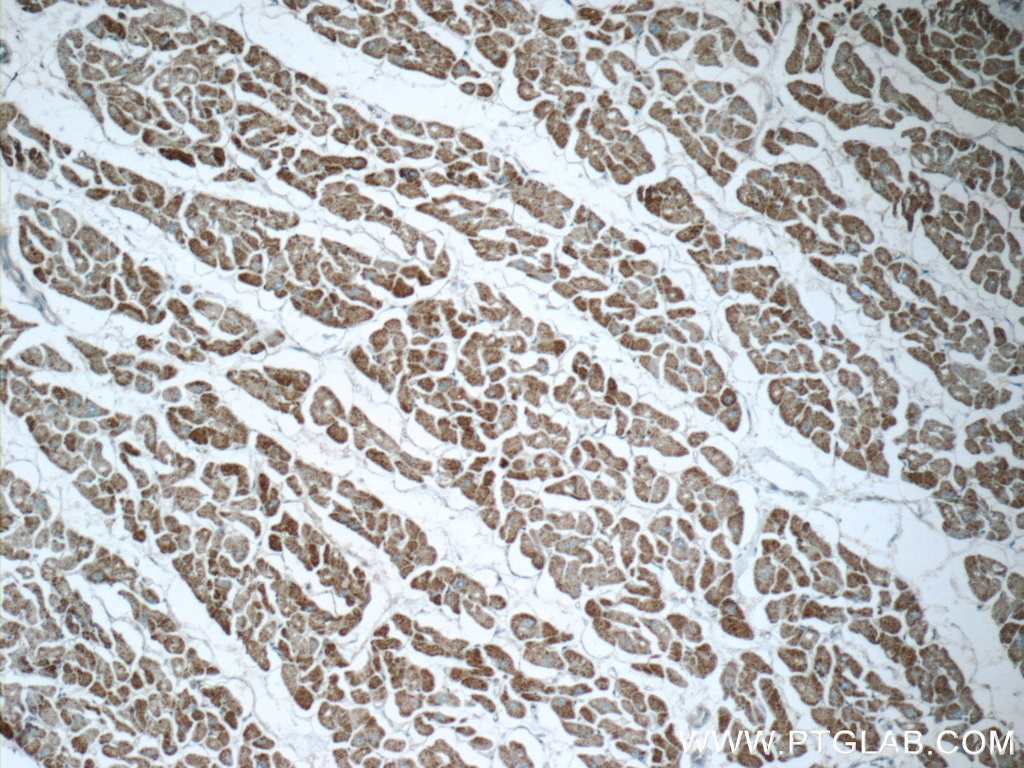 Immunohistochemistry (IHC) staining of human heart tissue using MMADHC Polyclonal antibody (23191-1-AP)