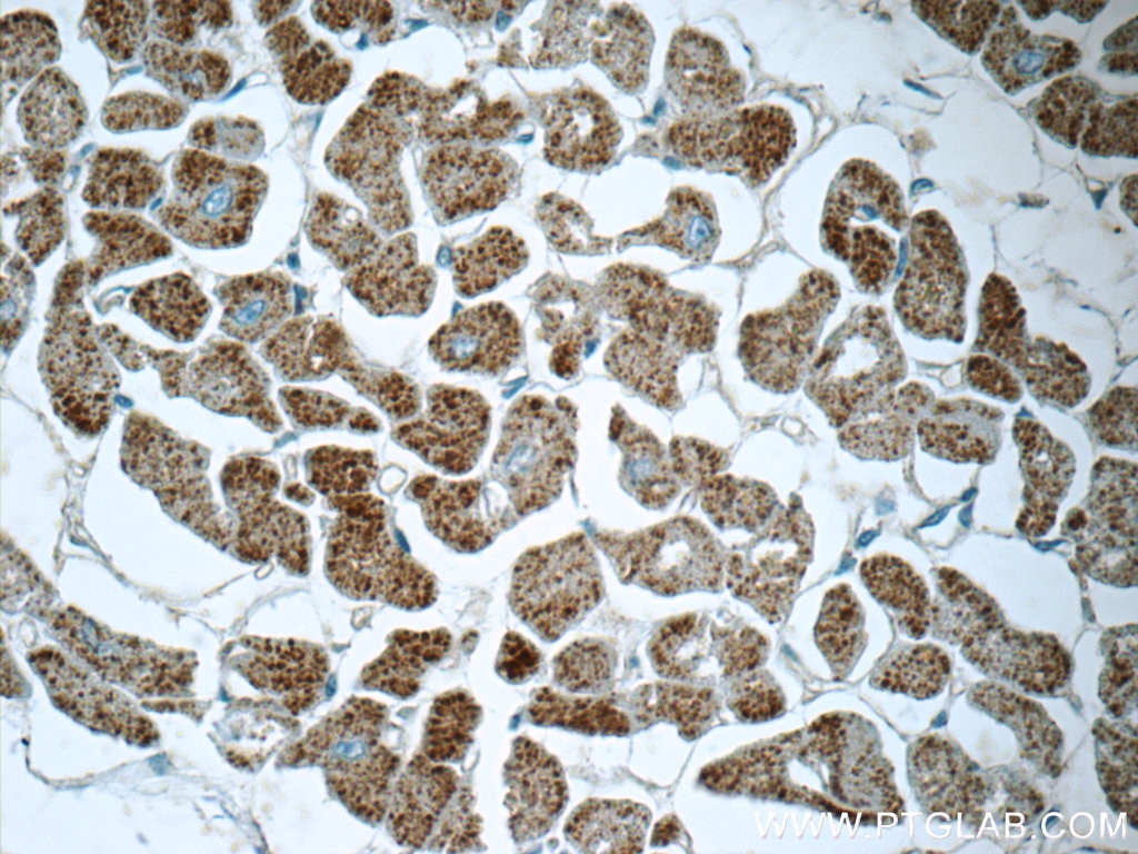 Immunohistochemistry (IHC) staining of human heart tissue using MMADHC Polyclonal antibody (23191-1-AP)