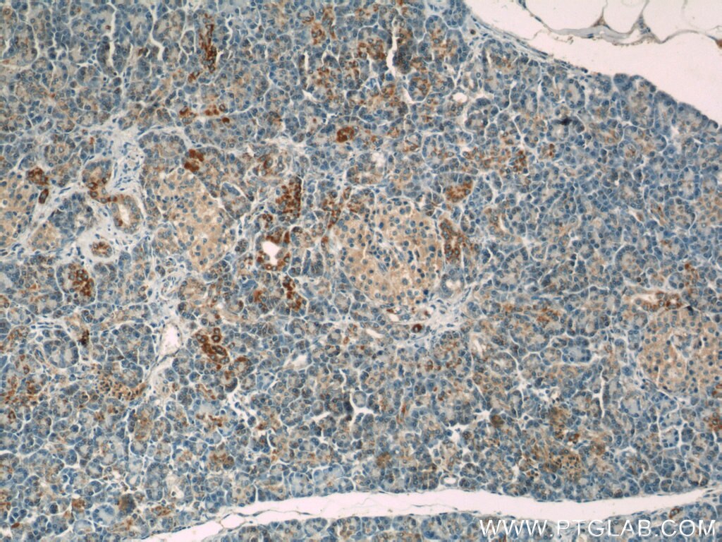 Immunohistochemistry (IHC) staining of human pancreas tissue using MMADHC Polyclonal antibody (23191-1-AP)