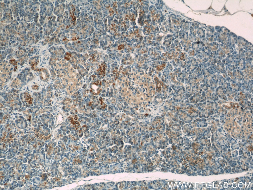 Immunohistochemistry (IHC) staining of human pancreas tissue using MMADHC Polyclonal antibody (23191-1-AP)