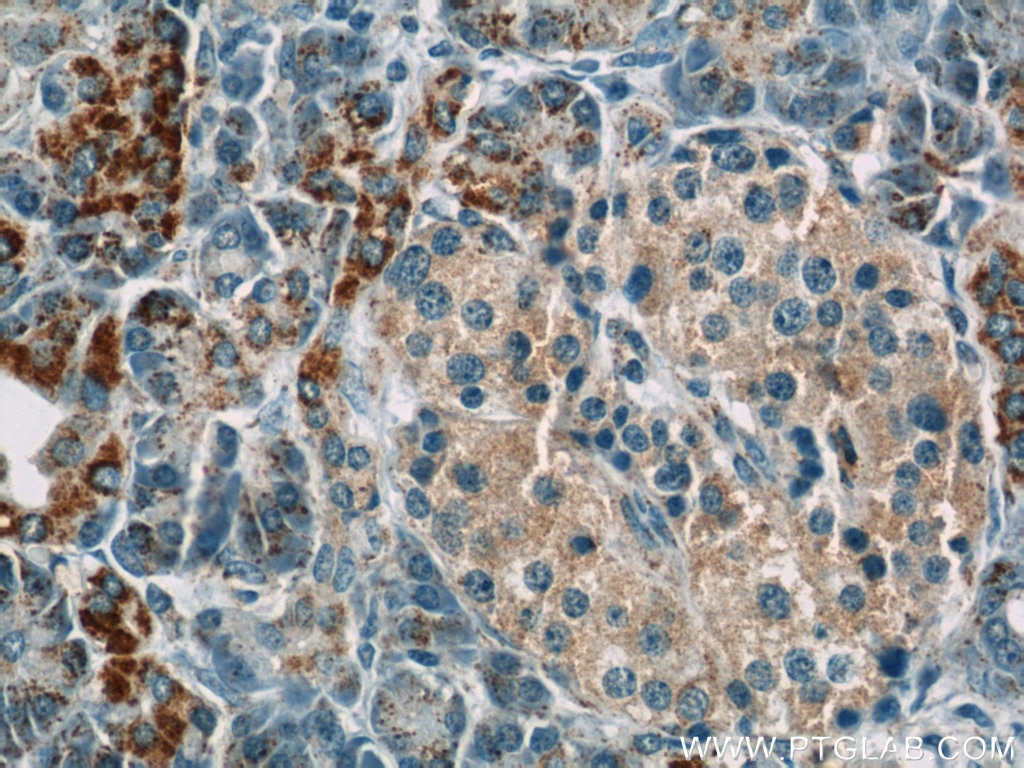 Immunohistochemistry (IHC) staining of human pancreas tissue using MMADHC Polyclonal antibody (23191-1-AP)