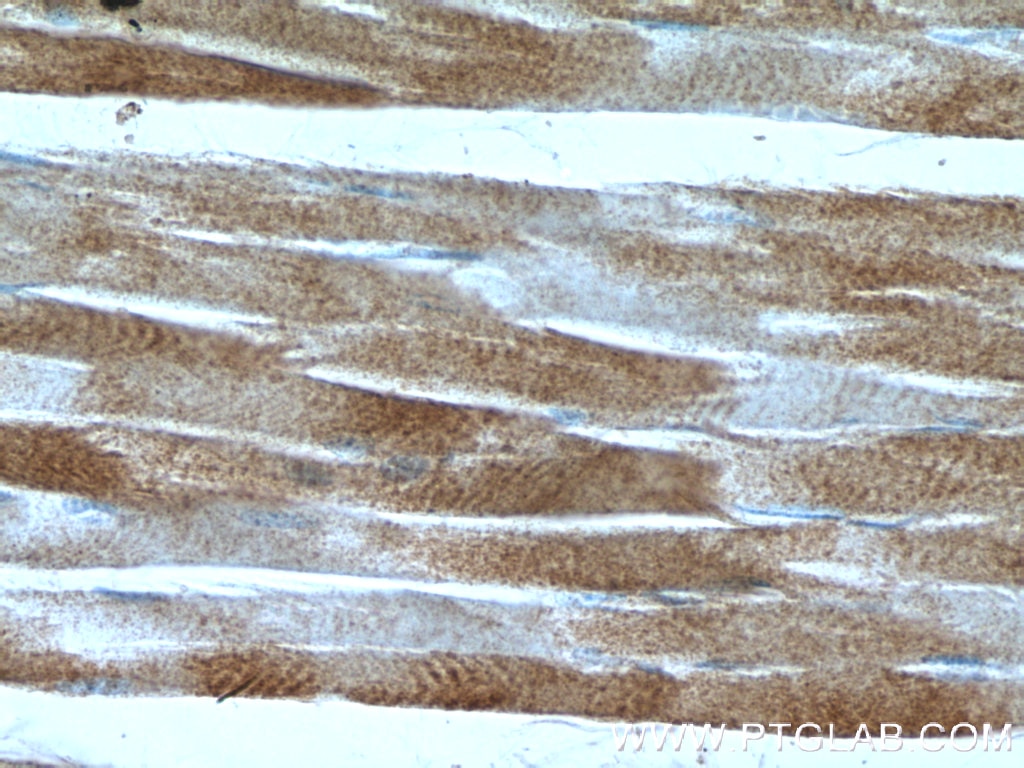 IHC staining of human skeletal muscle using 23191-1-AP
