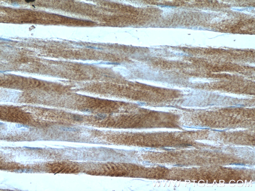 Immunohistochemistry (IHC) staining of human skeletal muscle tissue using MMADHC Polyclonal antibody (23191-1-AP)