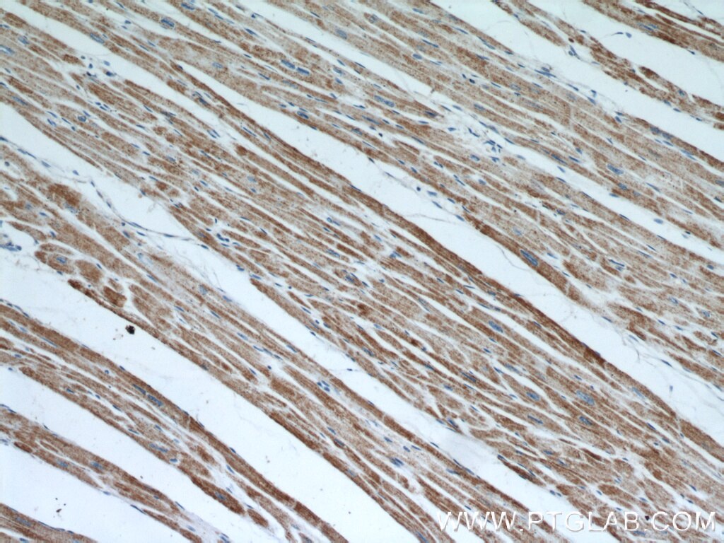 Immunohistochemistry (IHC) staining of human heart tissue using MMADHC Polyclonal antibody (23191-1-AP)