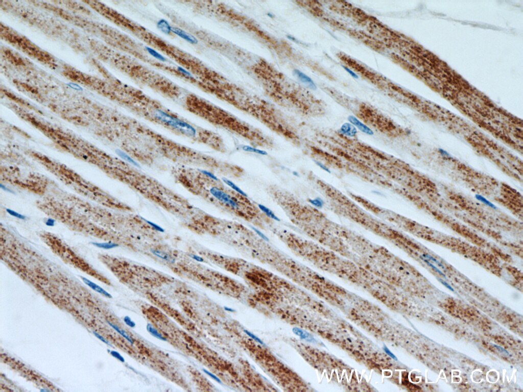 Immunohistochemistry (IHC) staining of human heart tissue using MMADHC Polyclonal antibody (23191-1-AP)