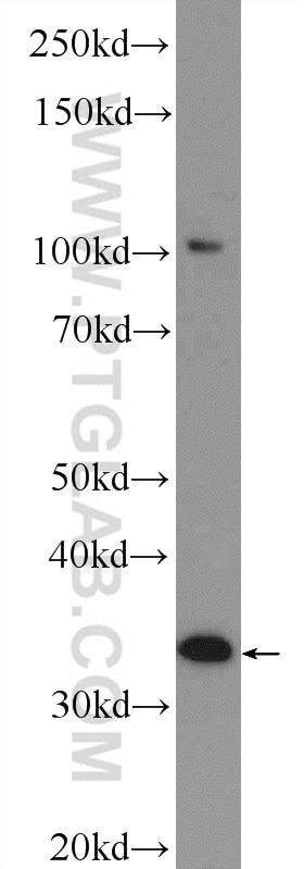 Western Blot (WB) analysis of HeLa cells using MMADHC Polyclonal antibody (23191-1-AP)