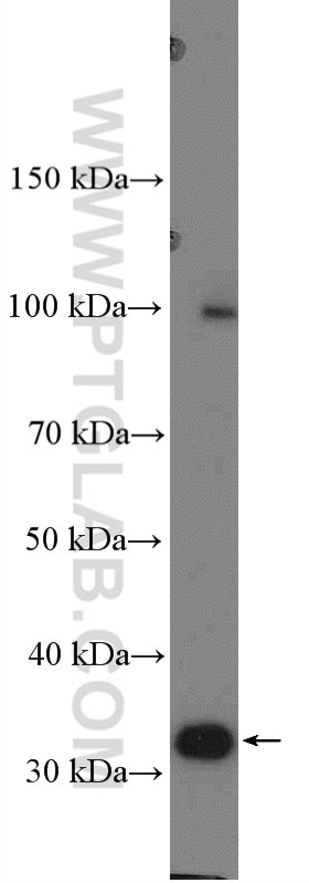Western Blot (WB) analysis of MCF-7 cells using MMADHC Polyclonal antibody (23191-1-AP)