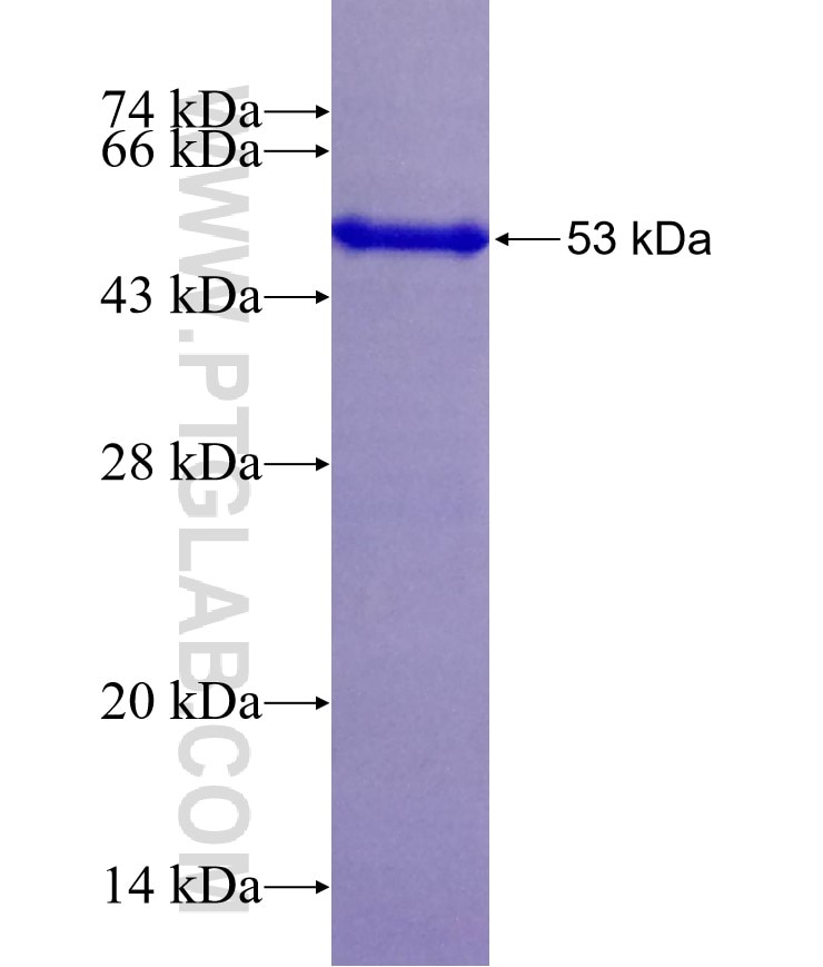 MMADHC fusion protein Ag19343 SDS-PAGE