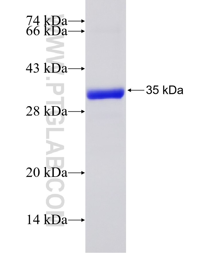 MMADHC fusion protein Ag19371 SDS-PAGE