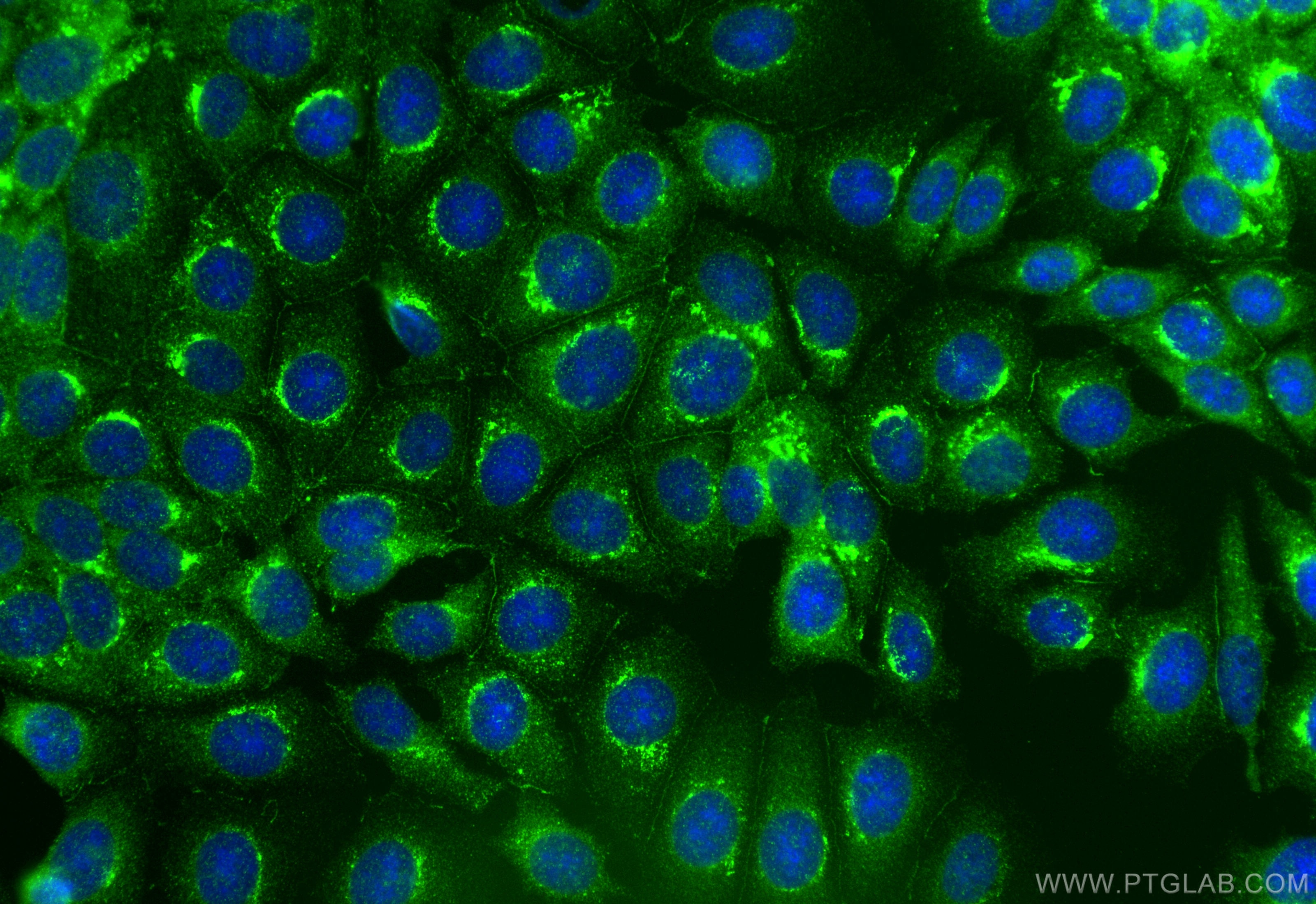 Immunofluorescence (IF) / fluorescent staining of MCF-7 cells using Neprilysin/CD10 Polyclonal antibody (10302-1-AP)