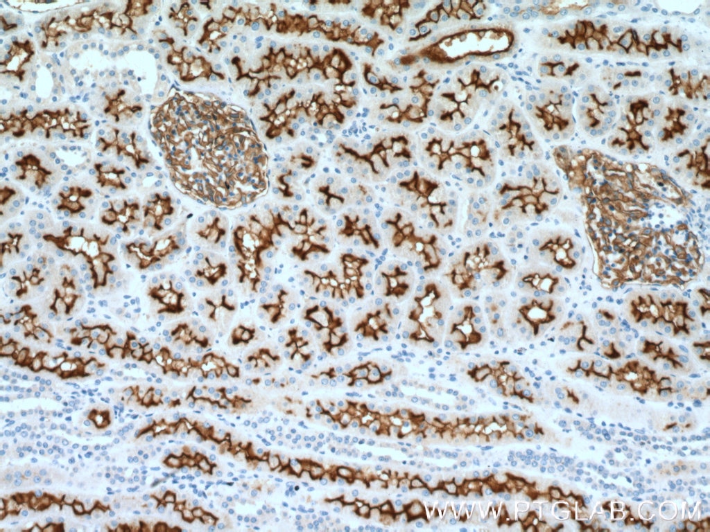 Immunohistochemistry (IHC) staining of human kidney tissue using MME,CD10 Polyclonal antibody (10302-1-AP)