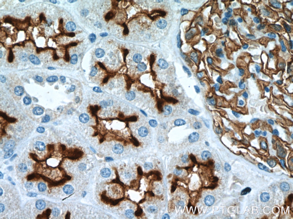 Immunohistochemistry (IHC) staining of human kidney tissue using MME,CD10 Polyclonal antibody (10302-1-AP)
