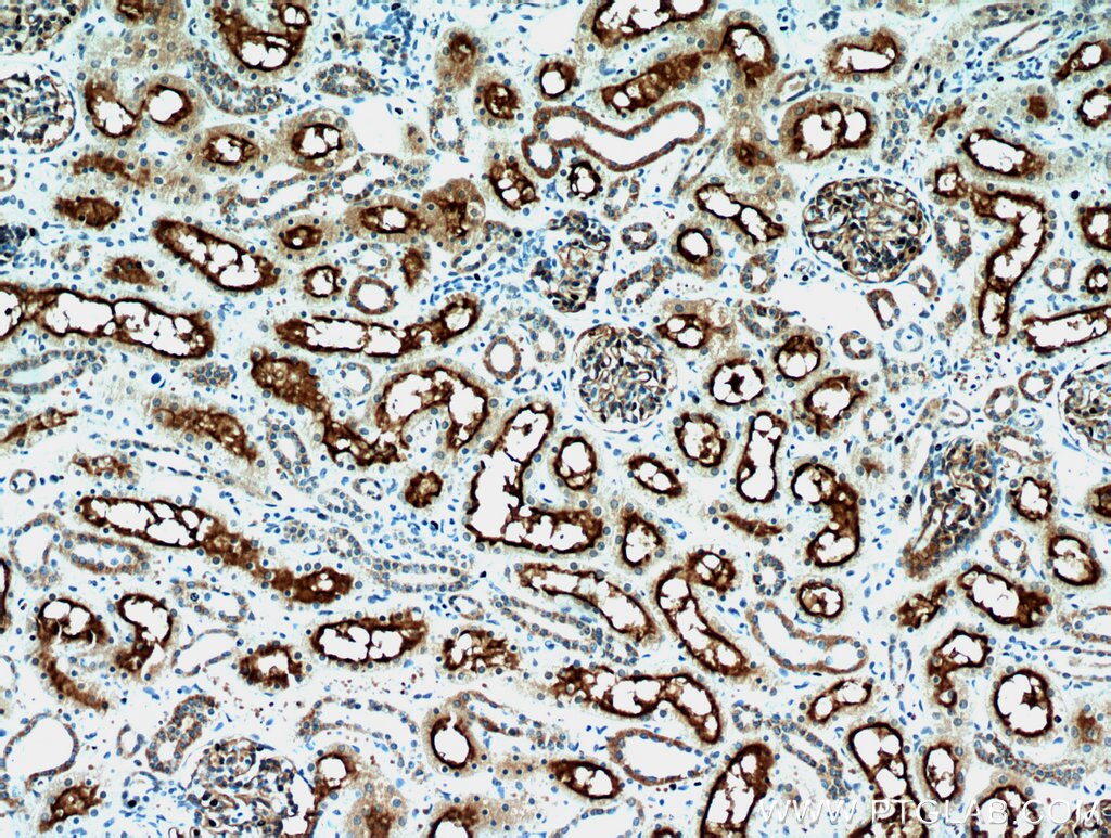 MME,CD10