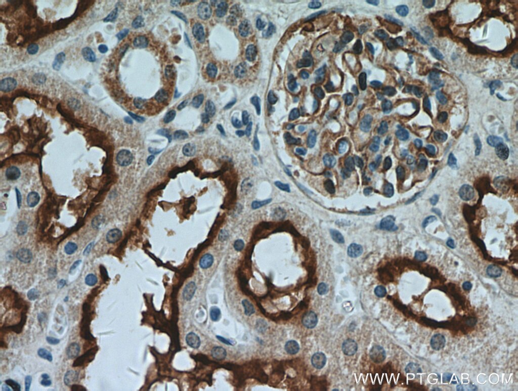 MME,CD10 Polyclonal antibody