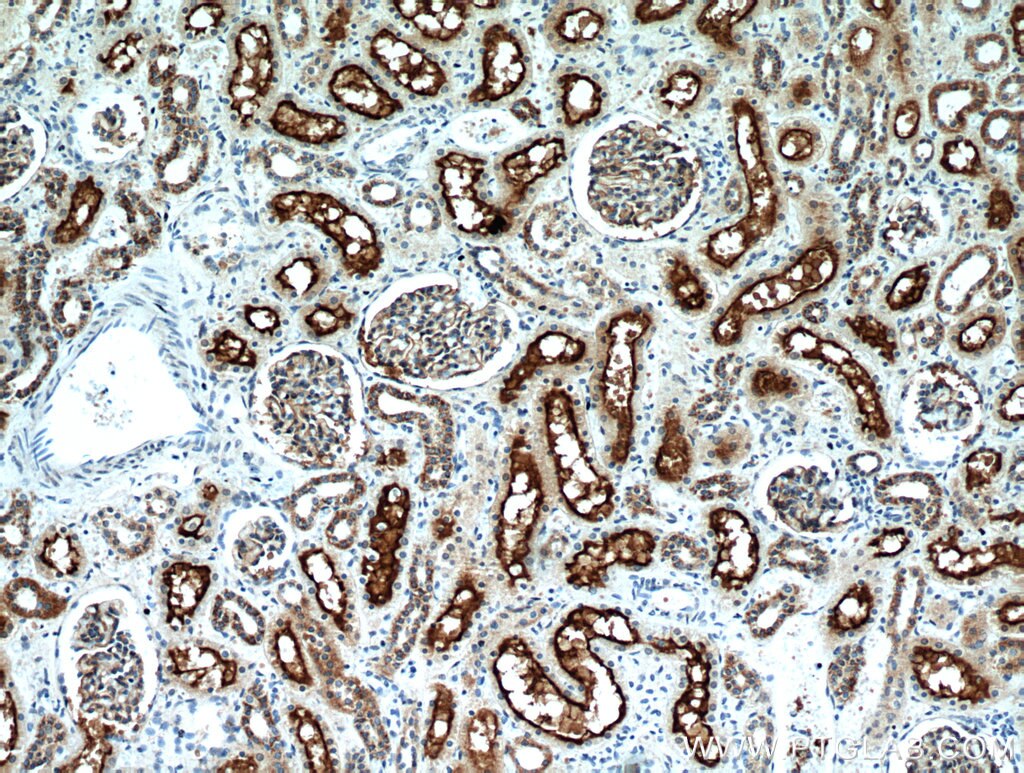 Immunohistochemistry (IHC) staining of human kidney tissue using MME,CD10 Polyclonal antibody (10302-1-AP)