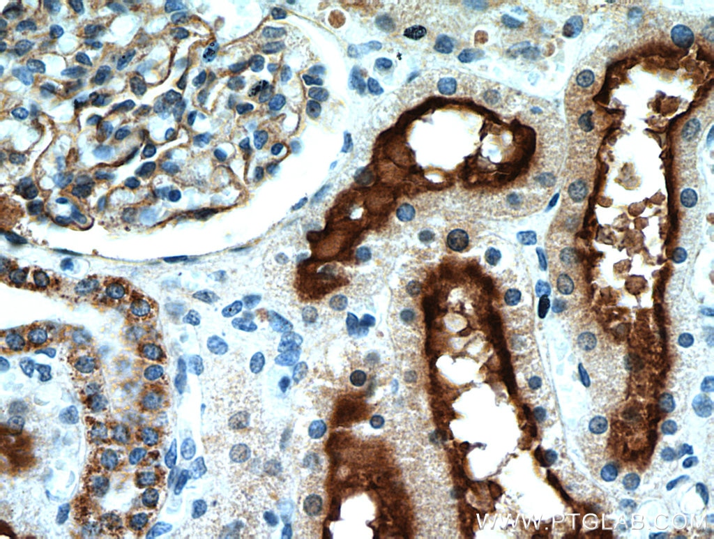 IHC staining of human kidney using 10302-1-AP