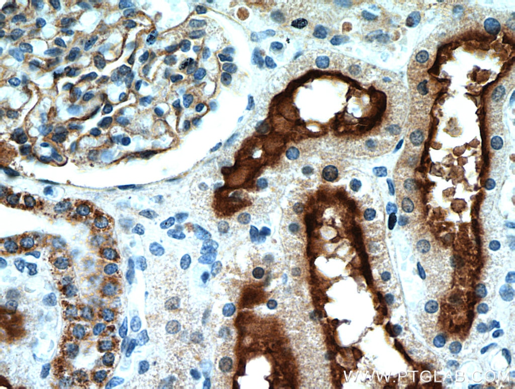 Immunohistochemistry (IHC) staining of human kidney tissue using MME,CD10 Polyclonal antibody (10302-1-AP)