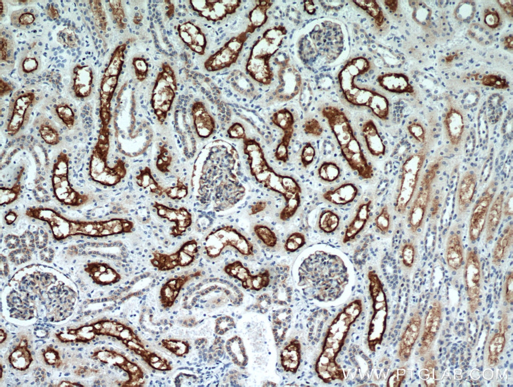 IHC staining of human kidney using 10302-1-AP