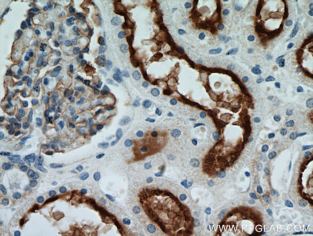 Immunohistochemistry (IHC) staining of human kidney tissue using MME,CD10 Polyclonal antibody (10302-1-AP)