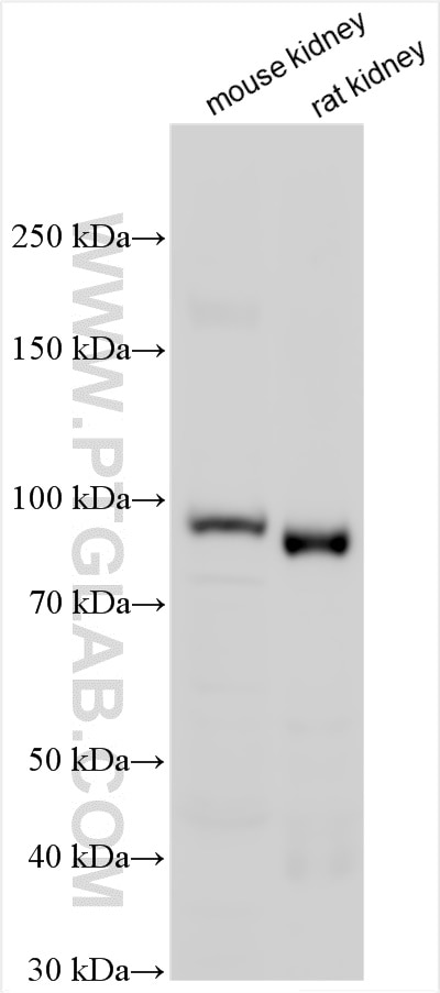 Western Blot (WB) analysis of various lysates using MME,CD10 Polyclonal antibody (10302-1-AP)