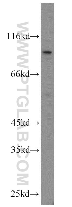 Western Blot (WB) analysis of HEK-293 cells using MME,CD10 Polyclonal antibody (10302-1-AP)