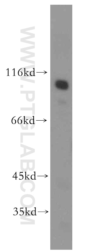 Western Blot (WB) analysis of mouse kidney tissue using MME,CD10 Polyclonal antibody (10302-1-AP)