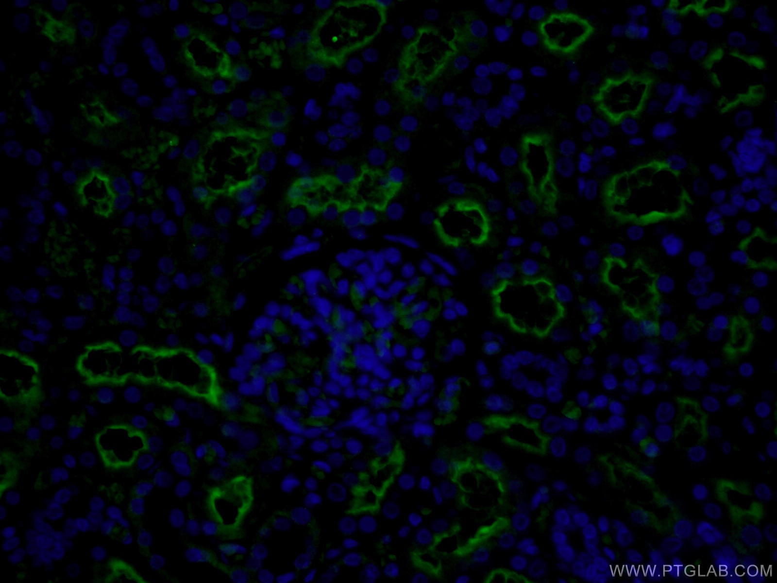 Immunofluorescence (IF) / fluorescent staining of human kidney tissue using MME,CD10 Polyclonal antibody (18008-1-AP)