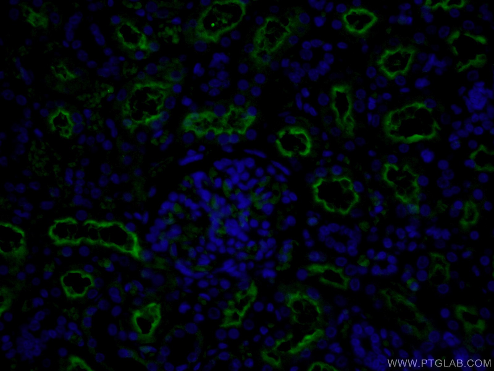 IF Staining of human kidney using 18008-1-AP