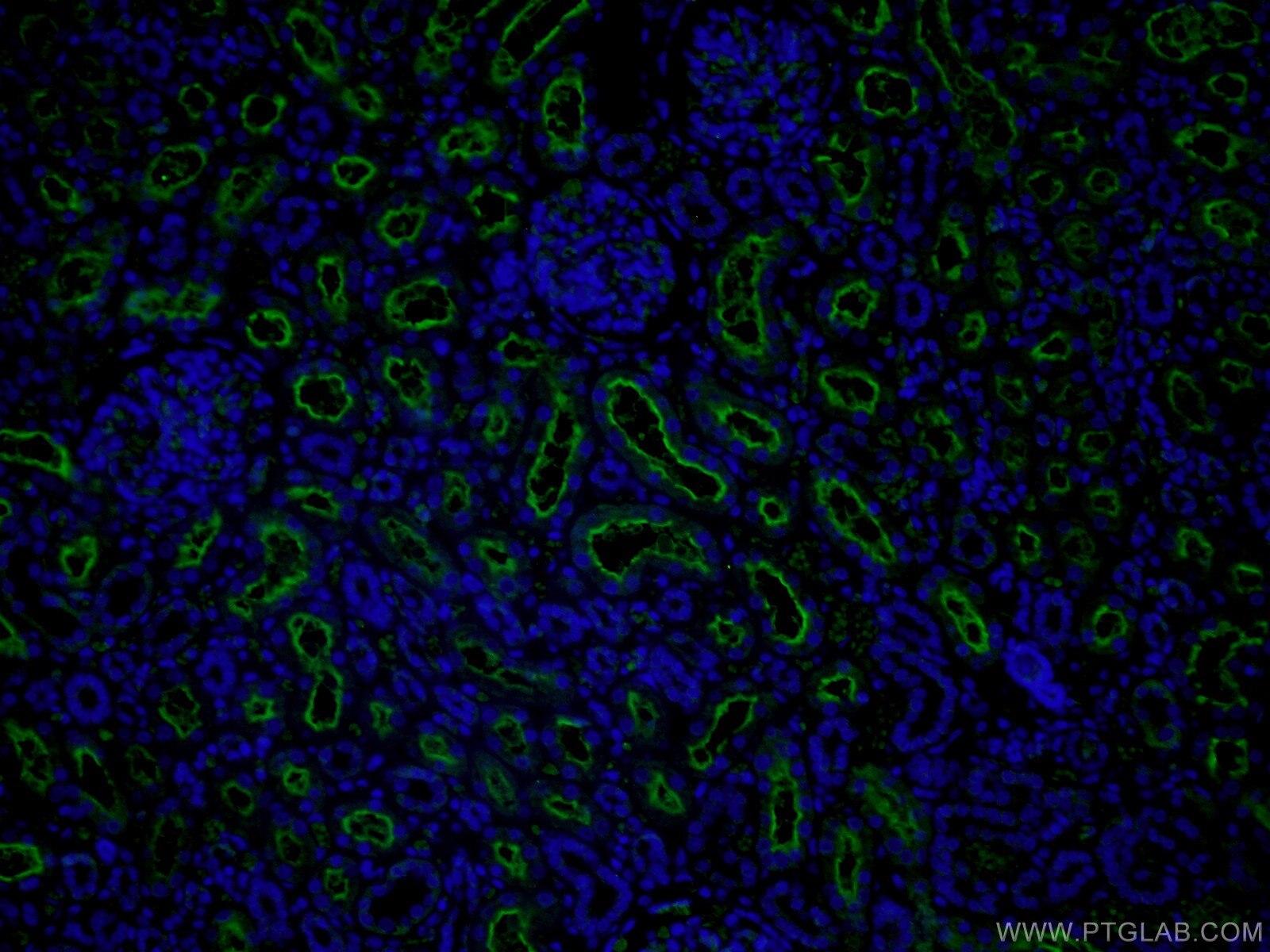 Immunofluorescence (IF) / fluorescent staining of human kidney tissue using MME,CD10 Polyclonal antibody (18008-1-AP)