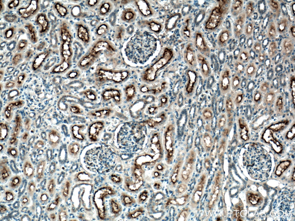 Immunohistochemistry (IHC) staining of human kidney tissue using MME,CD10 Polyclonal antibody (18008-1-AP)