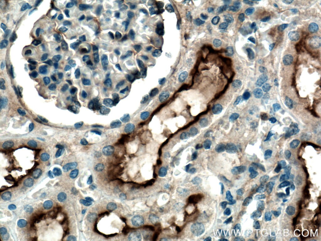 Immunohistochemistry (IHC) staining of human kidney tissue using MME,CD10 Polyclonal antibody (18008-1-AP)