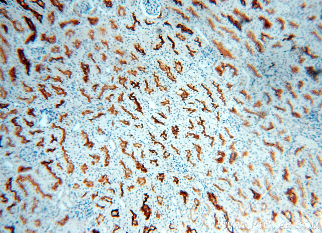 IHC staining of human kidney using 18008-1-AP