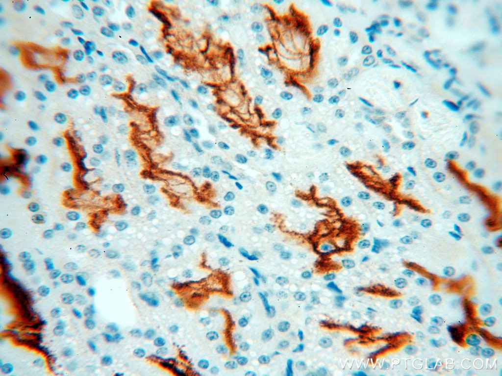 Immunohistochemistry (IHC) staining of human kidney tissue using MME,CD10 Polyclonal antibody (18008-1-AP)