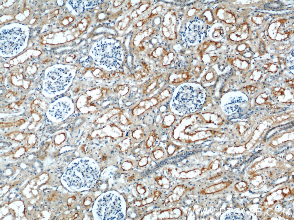 Immunohistochemistry (IHC) staining of human kidney tissue using MME,CD10 Polyclonal antibody (18008-1-AP)