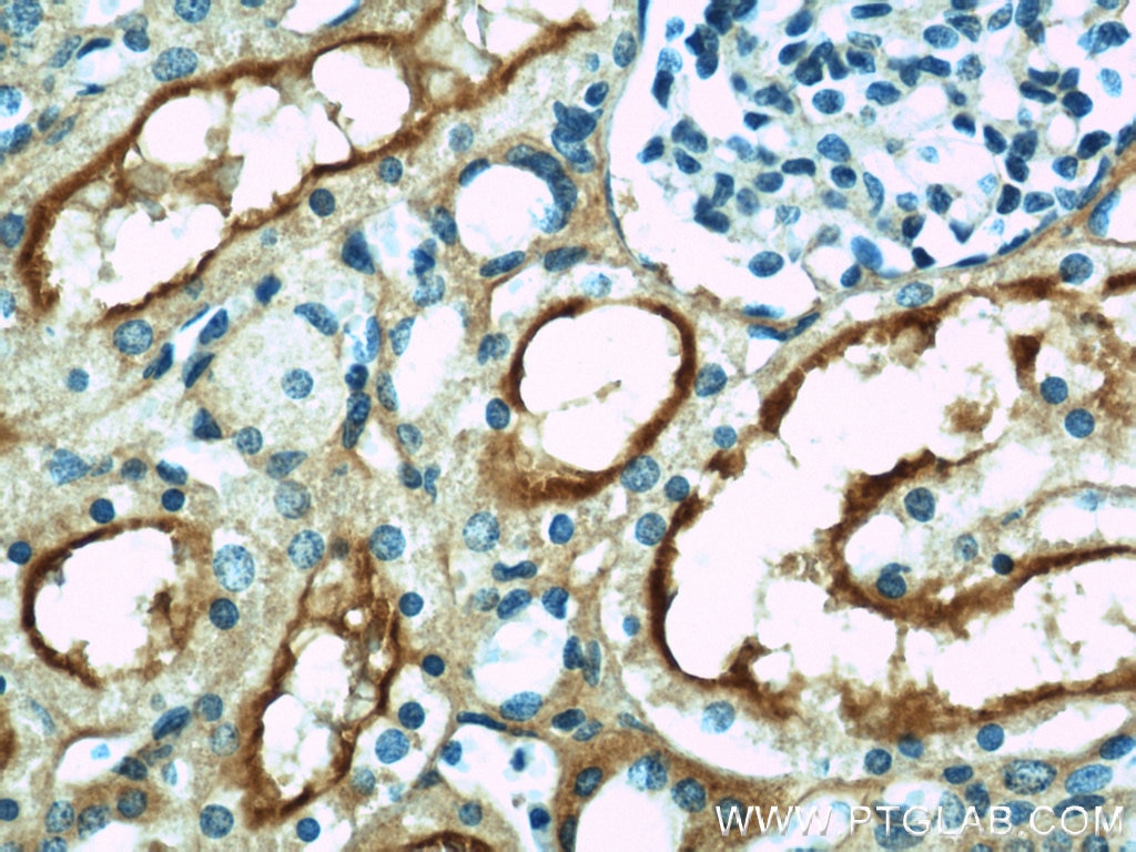 Immunohistochemistry (IHC) staining of human kidney tissue using MME,CD10 Polyclonal antibody (18008-1-AP)