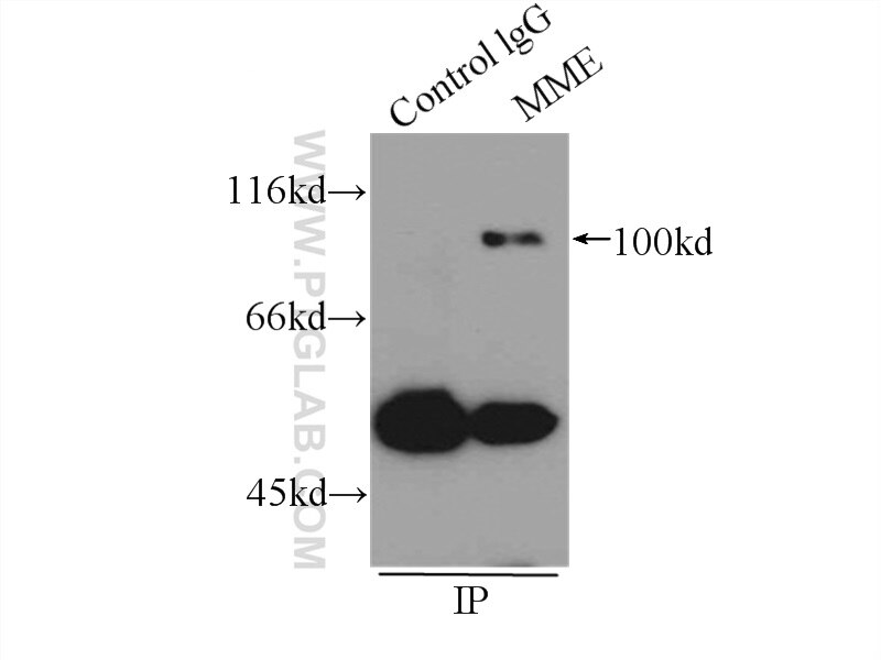 Immunoprecipitation (IP) experiment of Raji cells using MME,CD10 Polyclonal antibody (18008-1-AP)