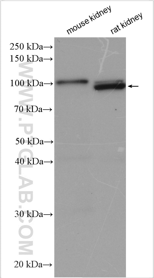 Western Blot (WB) analysis of various lysates using MME,CD10 Polyclonal antibody (18008-1-AP)