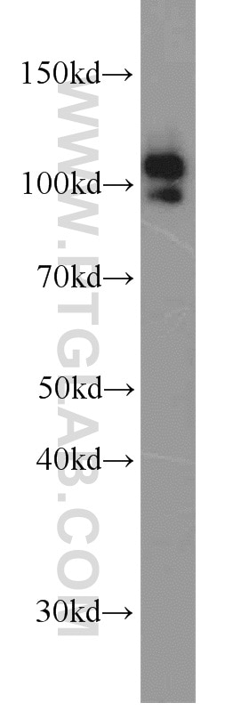 Western Blot (WB) analysis of human kidney tissue using MME,CD10 Polyclonal antibody (18008-1-AP)