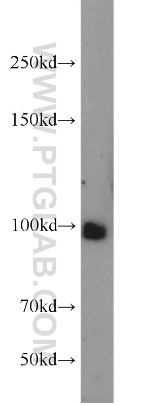 Western Blot (WB) analysis of rat kidney tissue using MME,CD10 Polyclonal antibody (18008-1-AP)