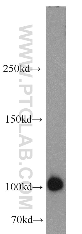 Western Blot (WB) analysis of mouse kidney tissue using MME,CD10 Polyclonal antibody (18008-1-AP)