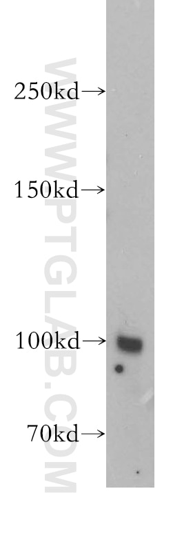 Western Blot (WB) analysis of mouse kidney tissue using Neprilysin/CD10 Polyclonal antibody (18008-1-AP)