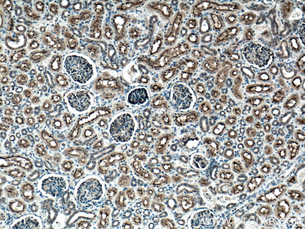 Immunohistochemistry (IHC) staining of human kidney tissue using MME,CD10 Polyclonal antibody (23898-1-AP)