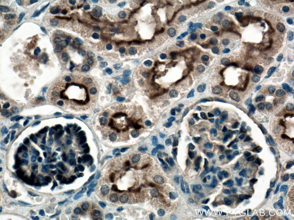 Immunohistochemistry (IHC) staining of human kidney tissue using MME,CD10 Polyclonal antibody (23898-1-AP)