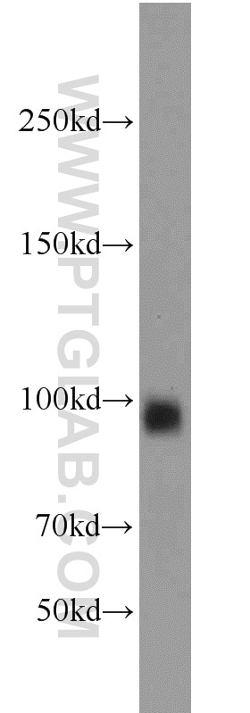 Western Blot (WB) analysis of rat kidney tissue using MME,CD10 Polyclonal antibody (23898-1-AP)