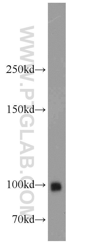 Western Blot (WB) analysis of mouse kidney tissue using MME,CD10 Polyclonal antibody (23898-1-AP)