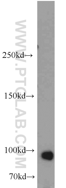 Western Blot (WB) analysis of rat kidney tissue using MME,CD10 Polyclonal antibody (23898-1-AP)