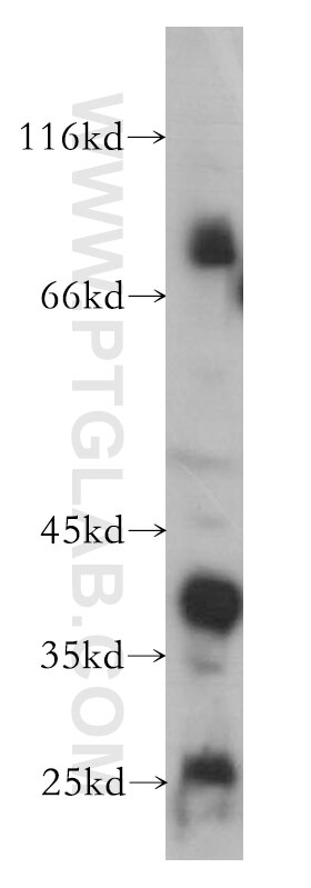 Western Blot (WB) analysis of human placenta tissue using MME,CD10 Monoclonal antibody (60034-1-Ig)